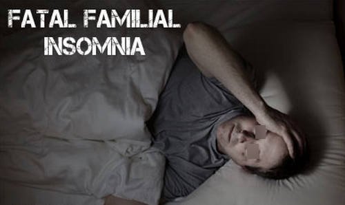 Fatal familial insomnia can lead to progressive deterioration and in a matter of months the patient could die image photo picture
